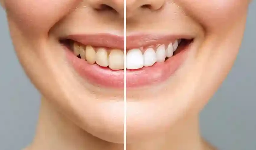  How Cosmetic Dentistry Can Benefit Your Life For The Science of Smiling